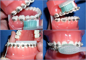 brushing and cleaning teeth