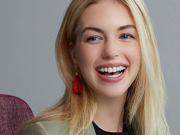 clear ceramic braces