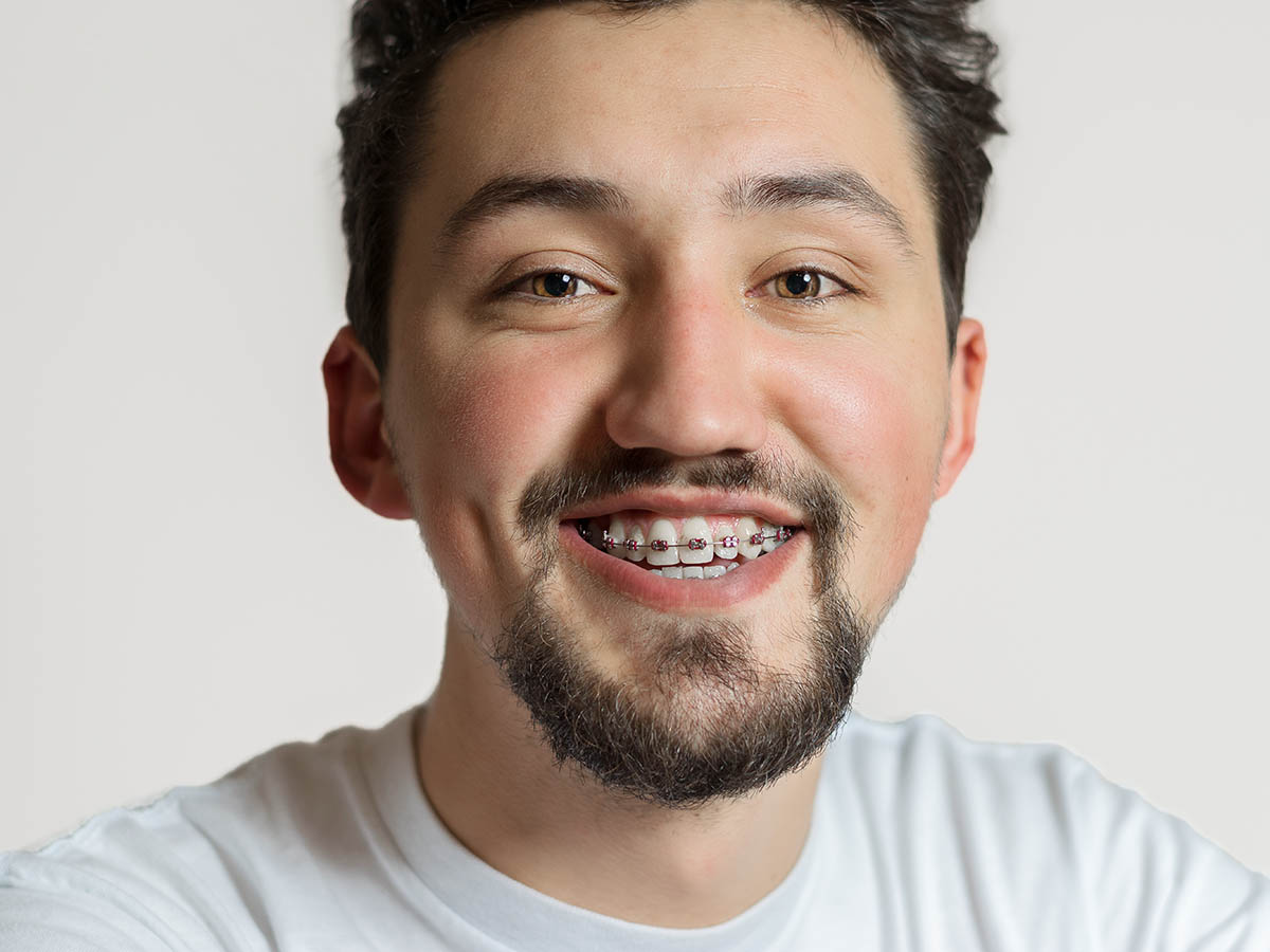 Portrait of a young man with braces smiling. A happy young man with braces on a white background.